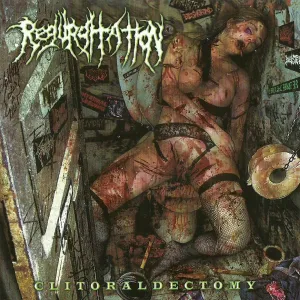 Clitoraldectomy